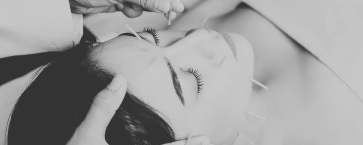 Acupuncture faciale